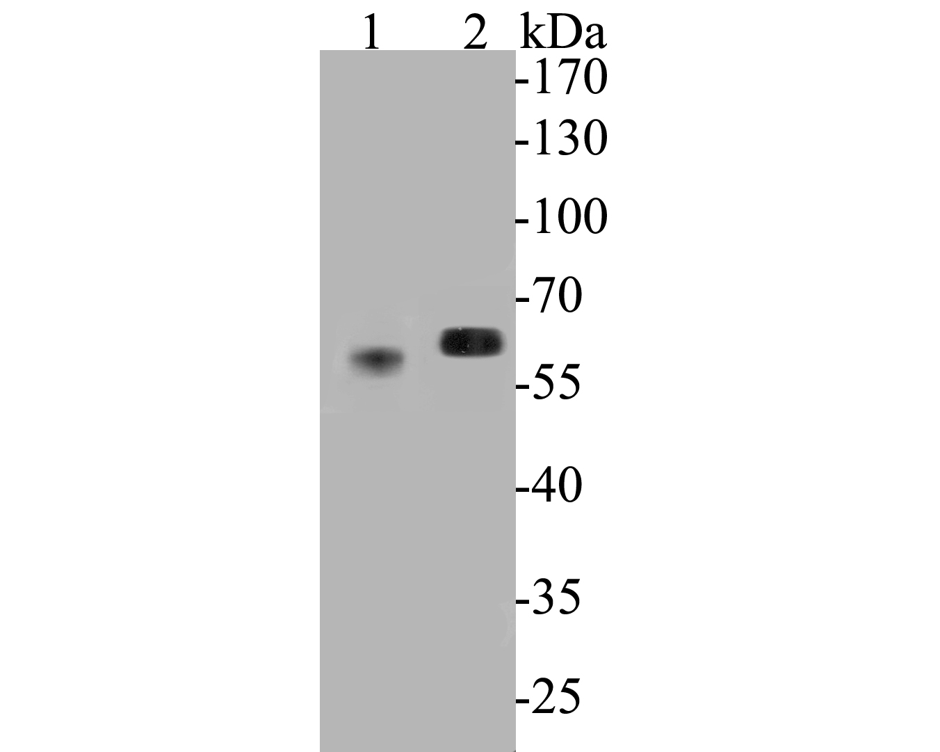 Western blot analysis of Syntrophin alpha 1 on different lysates. Proteins were transferred to a PVDF membrane and blocked with 5% BSA in PBS for 1 hour at room temperature. The primary antibody (ER1901-45, 1/500) was used in 5% BSA at room temperature for 2 hours. Goat Anti-Rabbit IgG - HRP Secondary Antibody (HA1001) at 1:5,000 dilution was used for 1 hour at room temperature.<br />
Positive control: <br />
Lane 1: mouse skeletal muscle tissue lysate<br />
Lane 2: rat skeletal muscle tissue lysate