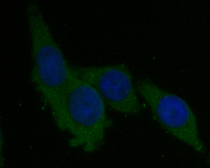 ICC staining of Syntrophin alpha 1 in SW620 cells (green). Formalin fixed cells were permeabilized with 0.1% Triton X-100 in TBS for 10 minutes at room temperature and blocked with 1% Blocker BSA for 15 minutes at room temperature. Cells were probed with the primary antibody (ER1901-45, 1/50) for 1 hour at room temperature, washed with PBS. Alexa Fluor®488 Goat anti-Rabbit IgG was used as the secondary antibody at 1/1,000 dilution. The nuclear counter stain is DAPI (blue).
