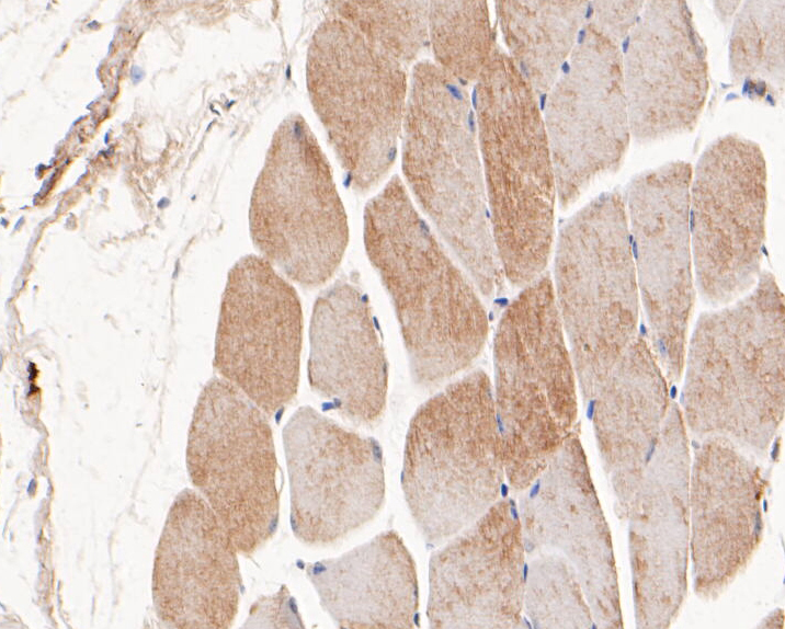 Immunohistochemical analysis of paraffin-embedded mouse skeletal muscle tissue using anti-Syntrophin alpha 1 antibody. The section was pre-treated using heat mediated antigen retrieval with Tris-EDTA buffer (pH 8.0-8.4) for 20 minutes.The tissues were blocked in 5% BSA for 30 minutes at room temperature, washed with ddH2O and PBS, and then probed with the primary antibody (ER1901-45, 1/50) for 30 minutes at room temperature. The detection was performed using an HRP conjugated compact polymer system. DAB was used as the chromogen. Tissues were counterstained with hematoxylin and mounted with DPX.