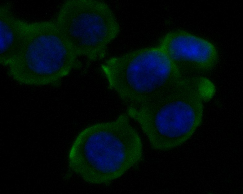 ICC staining of KCNK18 in N2A cells (green). Formalin fixed cells were permeabilized with 0.1% Triton X-100 in TBS for 10 minutes at room temperature and blocked with 1% Blocker BSA for 15 minutes at room temperature. Cells were probed with the primary antibody (ER1901-46, 1/50) for 1 hour at room temperature, washed with PBS. Alexa Fluor®488 Goat anti-Rabbit IgG was used as the secondary antibody at 1/1,000 dilution. The nuclear counter stain is DAPI (blue).