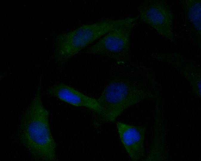 ICC staining of KCNK18 in SHG-44 cells (green). Formalin fixed cells were permeabilized with 0.1% Triton X-100 in TBS for 10 minutes at room temperature and blocked with 1% Blocker BSA for 15 minutes at room temperature. Cells were probed with the primary antibody (ER1901-46, 1/100) for 1 hour at room temperature, washed with PBS. Alexa Fluor®488 Goat anti-Rabbit IgG was used as the secondary antibody at 1/1,000 dilution. The nuclear counter stain is DAPI (blue).