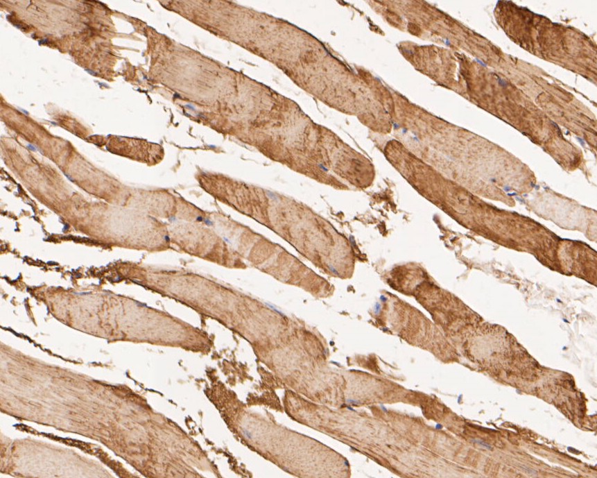 Immunohistochemical analysis of paraffin-embedded mouse skeletal muscle tissue using anti-KCNK18 antibody. The section was pre-treated using heat mediated antigen retrieval with Tris-EDTA buffer (pH 8.0-8.4) for 20 minutes.The tissues were blocked in 5% BSA for 30 minutes at room temperature, washed with ddH2O and PBS, and then probed with the primary antibody (ER1901-46, 1/50) for 30 minutes at room temperature. The detection was performed using an HRP conjugated compact polymer system. DAB was used as the chromogen. Tissues were counterstained with hematoxylin and mounted with DPX.