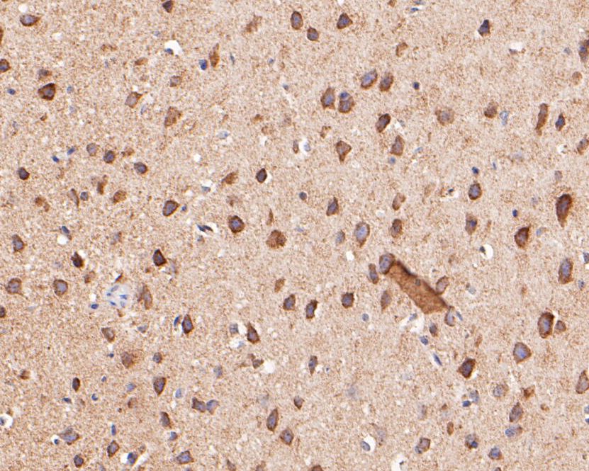 Immunohistochemical analysis of paraffin-embedded mouse brain tissue using anti-KCNK18 antibody. The section was pre-treated using heat mediated antigen retrieval with Tris-EDTA buffer (pH 8.0-8.4) for 20 minutes.The tissues were blocked in 5% BSA for 30 minutes at room temperature, washed with ddH2O and PBS, and then probed with the primary antibody (ER1901-46, 1/200) for 30 minutes at room temperature. The detection was performed using an HRP conjugated compact polymer system. DAB was used as the chromogen. Tissues were counterstained with hematoxylin and mounted with DPX.