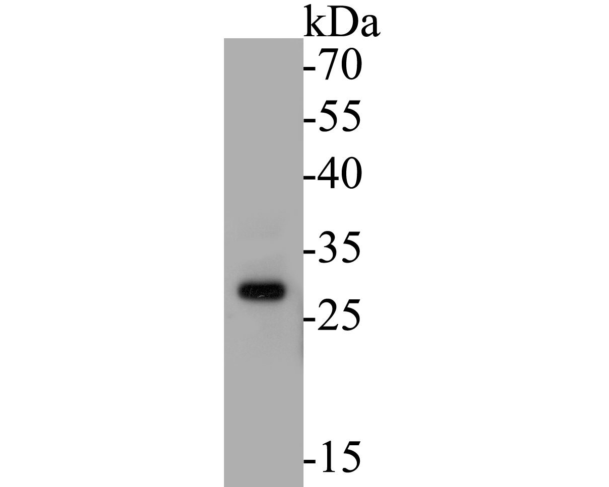 Western blot analysis of MTAP on PC-3M cell lysates. Proteins were transferred to a PVDF membrane and blocked with 5% BSA in PBS for 1 hour at room temperature. The primary antibody (ER1901-47, 1/500) was used in 5% BSA at room temperature for 2 hours. Goat Anti-Rabbit IgG - HRP Secondary Antibody (HA1001) at 1:5,000 dilution was used for 1 hour at room temperature.