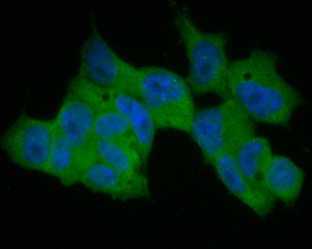 ICC staining of MTAP in F9 cells (green). Formalin fixed cells were permeabilized with 0.1% Triton X-100 in TBS for 10 minutes at room temperature and blocked with 1% Blocker BSA for 15 minutes at room temperature. Cells were probed with the primary antibody (ER1901-47, 1/50) for 1 hour at room temperature, washed with PBS. Alexa Fluor®488 Goat anti-Rabbit IgG was used as the secondary antibody at 1/1,000 dilution. The nuclear counter stain is DAPI (blue).