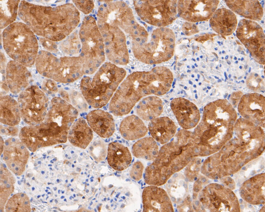 Immunohistochemical analysis of paraffin-embedded rat kidney tissue using anti-MTAP antibody. The section was pre-treated using heat mediated antigen retrieval with sodium citrate buffer (pH 6.0) for 20 minutes. The tissues were blocked in 5% BSA for 30 minutes at room temperature, washed with ddH2O and PBS, and then probed with the primary antibody (ER1901-47, 1/200)  for 30 minutes at room temperature. The detection was performed using an HRP conjugated compact polymer system. DAB was used as the chromogen. Tissues were counterstained with hematoxylin and mounted with DPX.