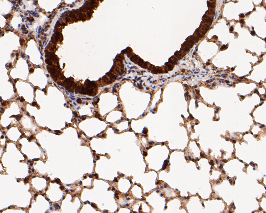 Immunohistochemical analysis of paraffin-embedded mouse lung tissue using anti-MTAP antibody. The section was pre-treated using heat mediated antigen retrieval with sodium citrate buffer (pH 6.0) for 20 minutes. The tissues were blocked in 5% BSA for 30 minutes at room temperature, washed with ddH2O and PBS, and then probed with the primary antibody (ER1901-47, 1/200)  for 30 minutes at room temperature. The detection was performed using an HRP conjugated compact polymer system. DAB was used as the chromogen. Tissues were counterstained with hematoxylin and mounted with DPX.