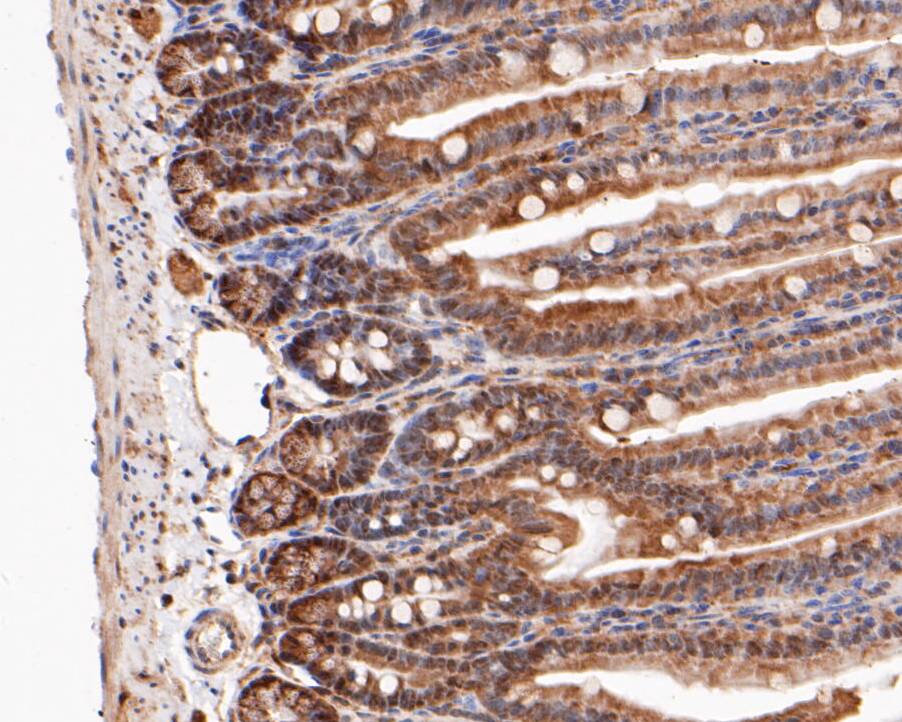 Immunohistochemical analysis of paraffin-embedded mouse colon tissue using anti-MTAP antibody. The section was pre-treated using heat mediated antigen retrieval with sodium citrate buffer (pH 6.0) for 20 minutes. The tissues were blocked in 5% BSA for 30 minutes at room temperature, washed with ddH2O and PBS, and then probed with the primary antibody (ER1901-47, 1/200)  for 30 minutes at room temperature. The detection was performed using an HRP conjugated compact polymer system. DAB was used as the chromogen. Tissues were counterstained with hematoxylin and mounted with DPX.