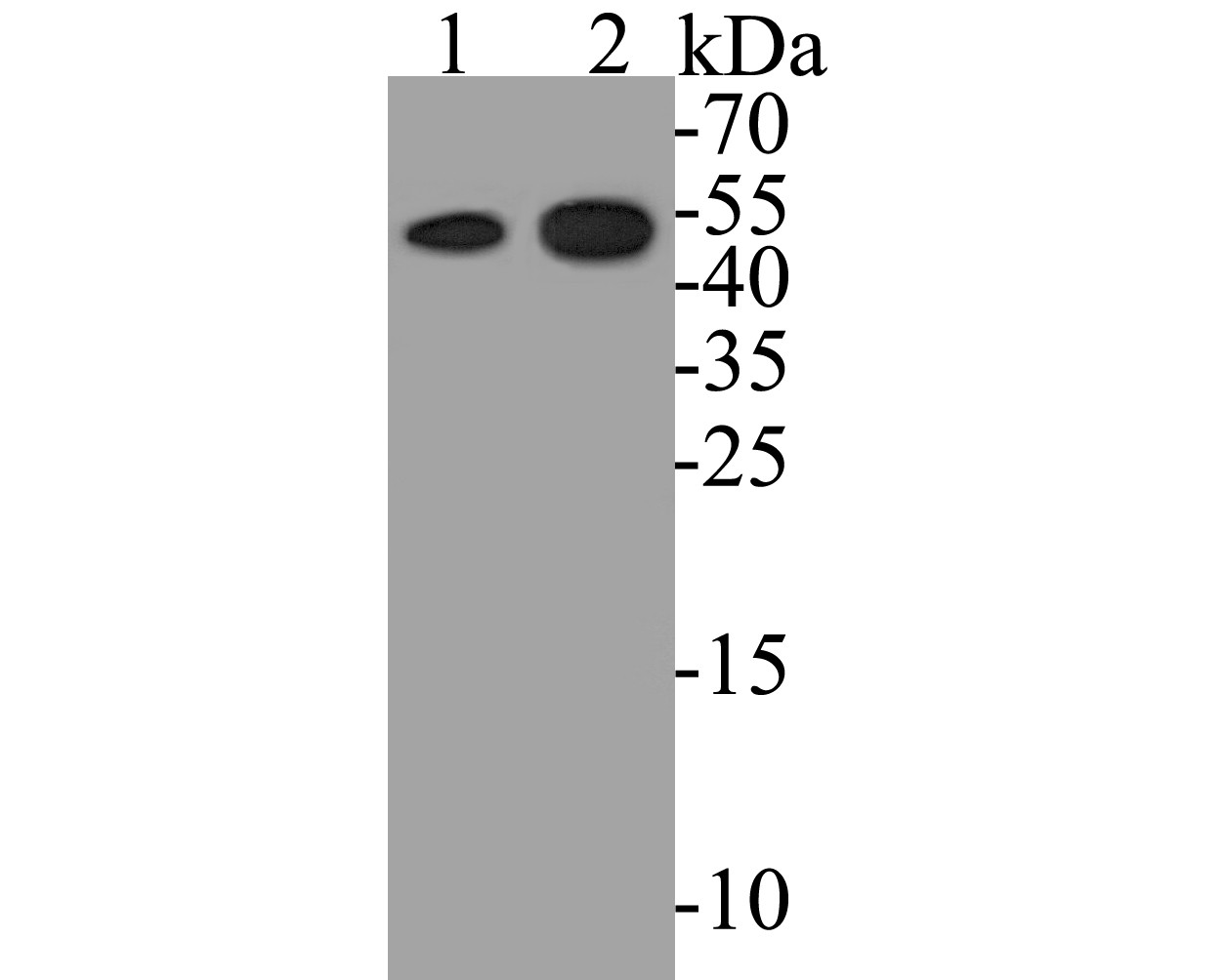 Western blot analysis of ZAC on different lysates. Proteins were transferred to a PVDF membrane and blocked with 5% BSA in PBS for 1 hour at room temperature. The primary antibody (ER1901-48, 1/500) was used in 5% BSA at room temperature for 2 hours. Goat Anti-Rabbit IgG - HRP Secondary Antibody (HA1001) at 1:5,000 dilution was used for 1 hour at room temperature.<br />
Positive control: <br />
Lane 1: human kidney tissue lysate<br />
Lane 2: HepG2 cell lysate