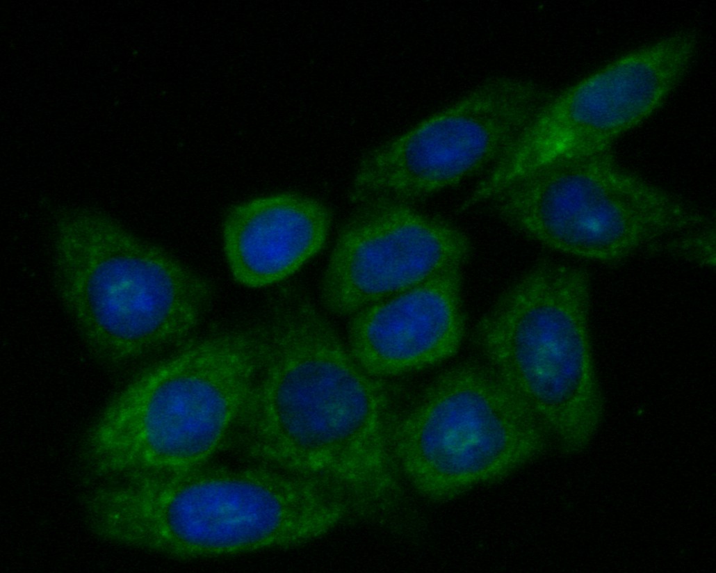 ICC staining of ZAC in SiHa cells (green). Formalin fixed cells were permeabilized with 0.1% Triton X-100 in TBS for 10 minutes at room temperature and blocked with 1% Blocker BSA for 15 minutes at room temperature. Cells were probed with the primary antibody (ER1901-48, 1/200) for 1 hour at room temperature, washed with PBS. Alexa Fluor®488 Goat anti-Rabbit IgG was used as the secondary antibody at 1/1,000 dilution. The nuclear counter stain is DAPI (blue).