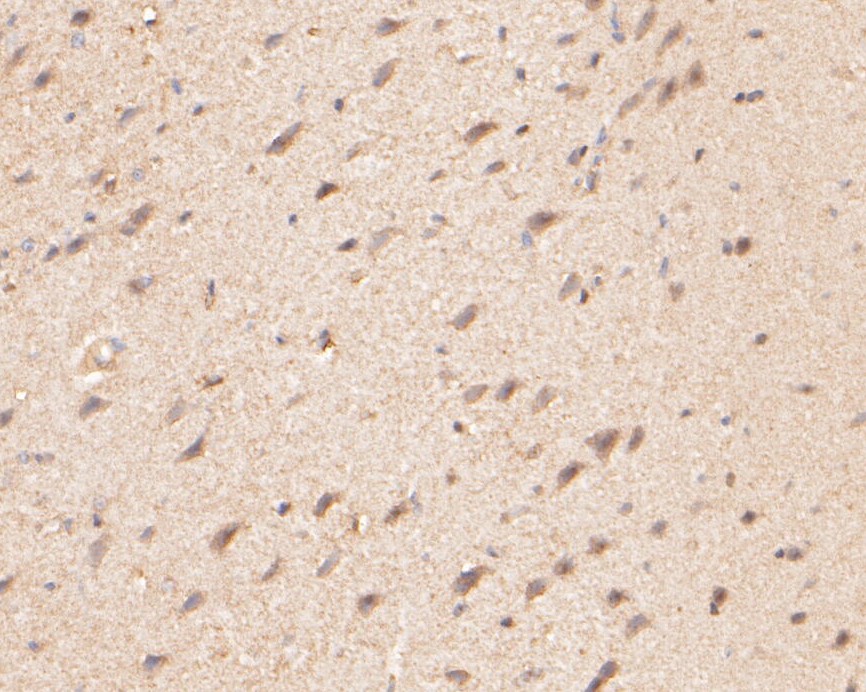 Immunohistochemical analysis of paraffin-embedded rat brain tissue using anti-ZAC antibody. The section was pre-treated using heat mediated antigen retrieval with Tris-EDTA buffer (pH 8.0-8.4) for 20 minutes.The tissues were blocked in 5% BSA for 30 minutes at room temperature, washed with ddH2O and PBS, and then probed with the primary antibody (ER1901-48, 1/200) for 30 minutes at room temperature. The detection was performed using an HRP conjugated compact polymer system. DAB was used as the chromogen. Tissues were counterstained with hematoxylin and mounted with DPX.