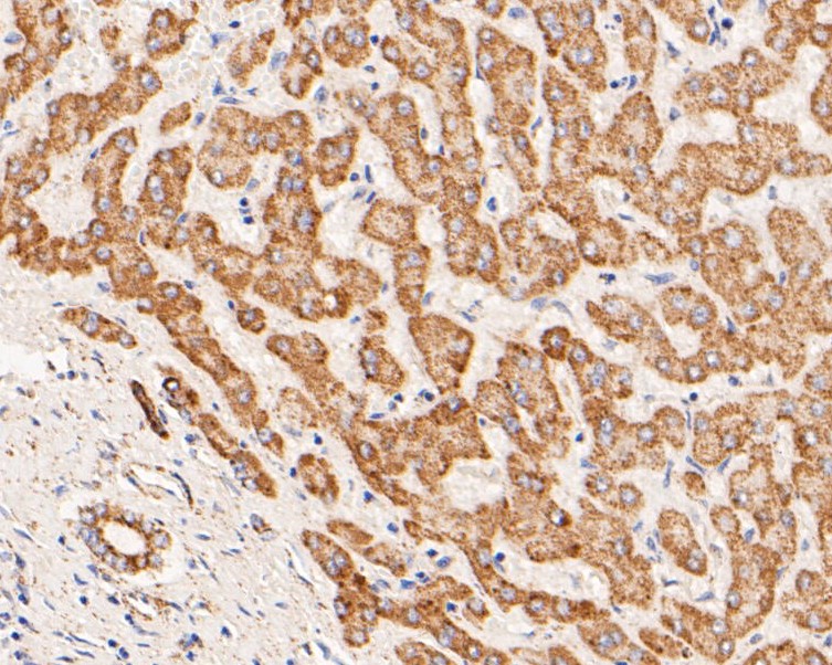 Immunohistochemical analysis of paraffin-embedded human liver tissue using anti-ZAC antibody. The section was pre-treated using heat mediated antigen retrieval with Tris-EDTA buffer (pH 8.0-8.4) for 20 minutes.The tissues were blocked in 5% BSA for 30 minutes at room temperature, washed with ddH2O and PBS, and then probed with the primary antibody (ER1901-48, 1/200) for 30 minutes at room temperature. The detection was performed using an HRP conjugated compact polymer system. DAB was used as the chromogen. Tissues were counterstained with hematoxylin and mounted with DPX.