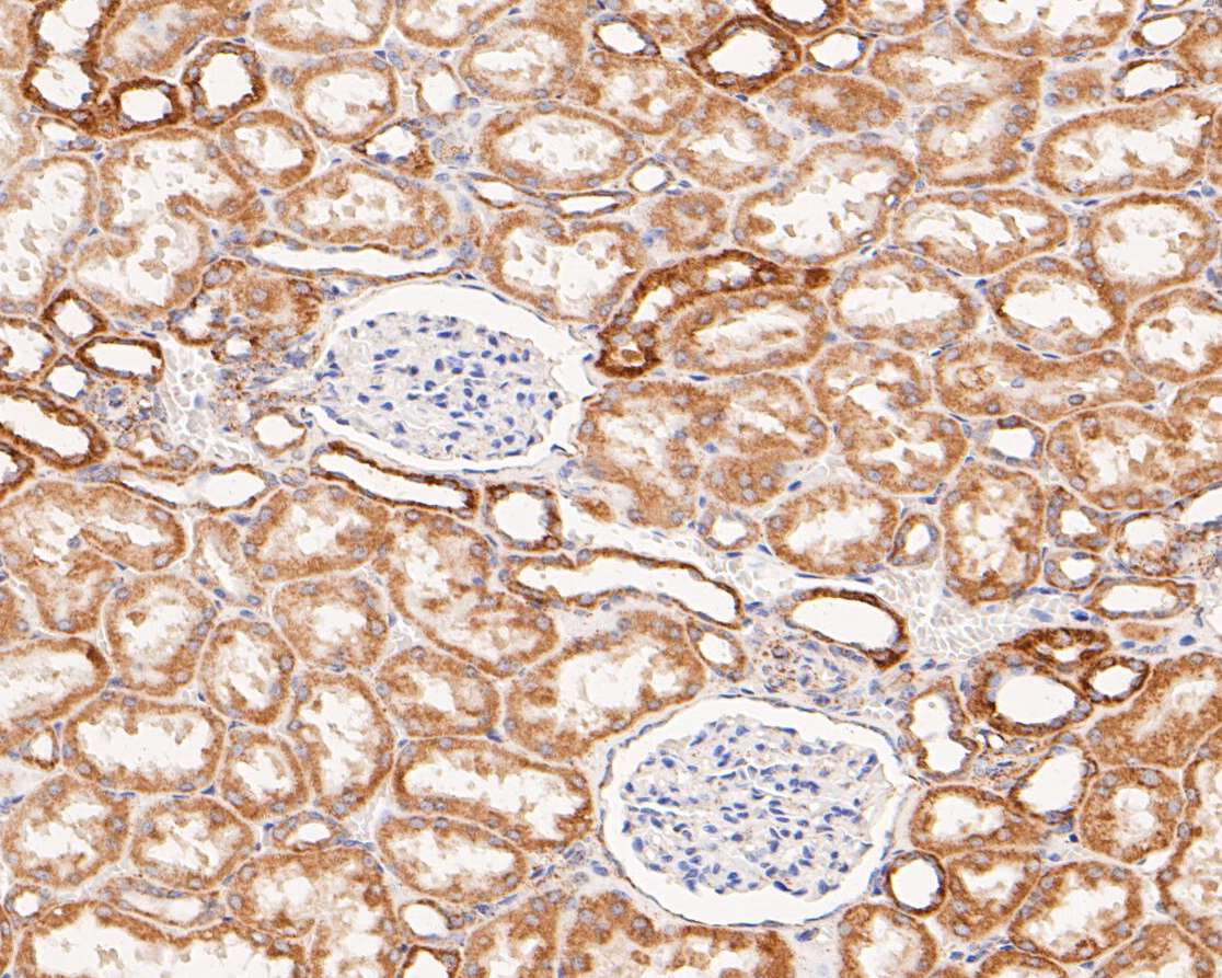 Immunohistochemical analysis of paraffin-embedded human kidney tissue using anti-ZAC antibody. The section was pre-treated using heat mediated antigen retrieval with Tris-EDTA buffer (pH 8.0-8.4) for 20 minutes.The tissues were blocked in 5% BSA for 30 minutes at room temperature, washed with ddH2O and PBS, and then probed with the primary antibody (ER1901-48, 1/200) for 30 minutes at room temperature. The detection was performed using an HRP conjugated compact polymer system. DAB was used as the chromogen. Tissues were counterstained with hematoxylin and mounted with DPX.