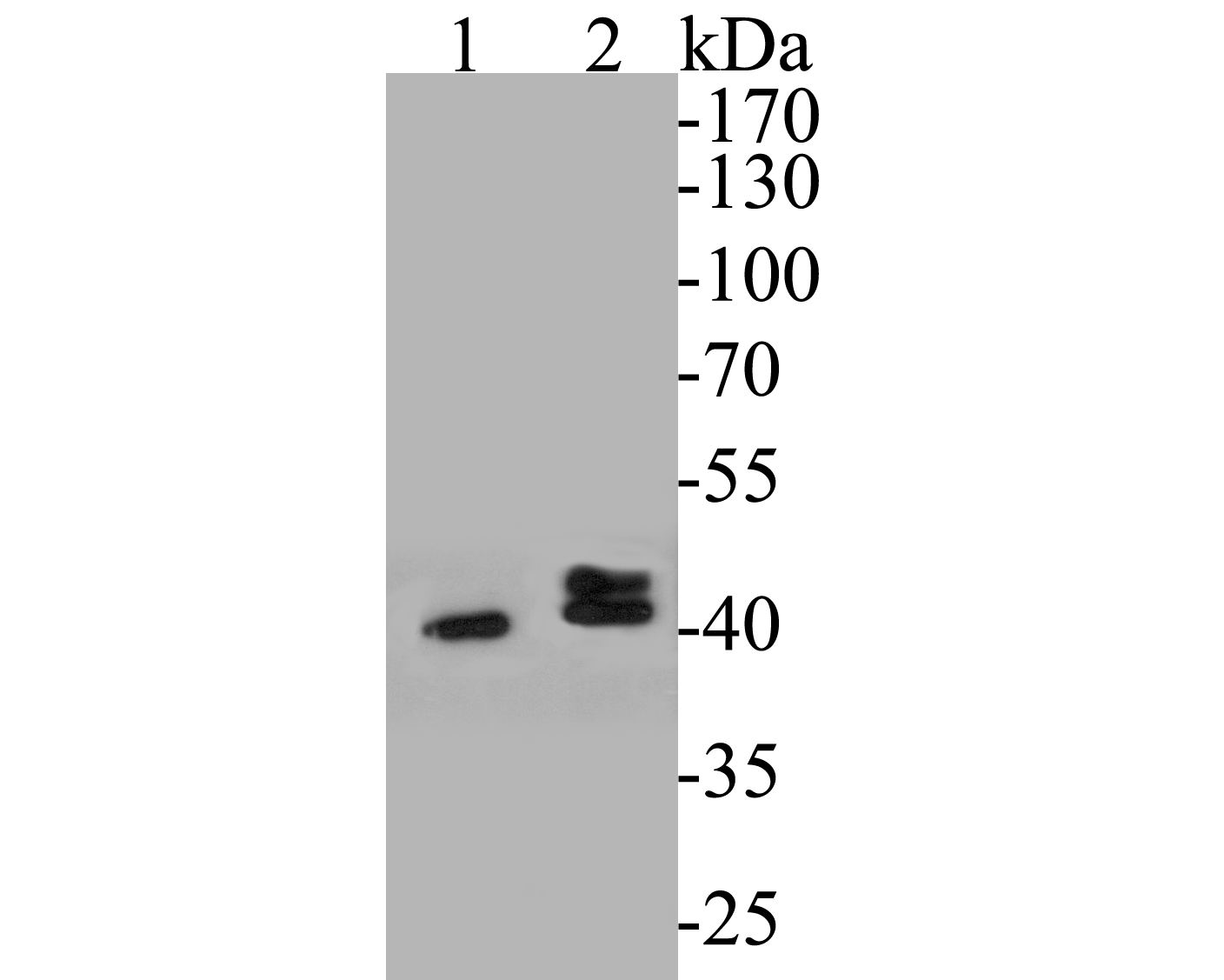 Western blot analysis of P2X6 on different lysates. Proteins were transferred to a PVDF membrane and blocked with 5% BSA in PBS for 1 hour at room temperature. The primary antibody (ER1901-49, 1/500) was used in 5% BSA at room temperature for 2 hours. Goat Anti-Rabbit IgG - HRP Secondary Antibody (HA1001) at 1:5,000 dilution was used for 1 hour at room temperature.<br />
Positive control: <br />
Lane 1: Jurkat cell lysate<br />
Lane 2: K562 cell lysate