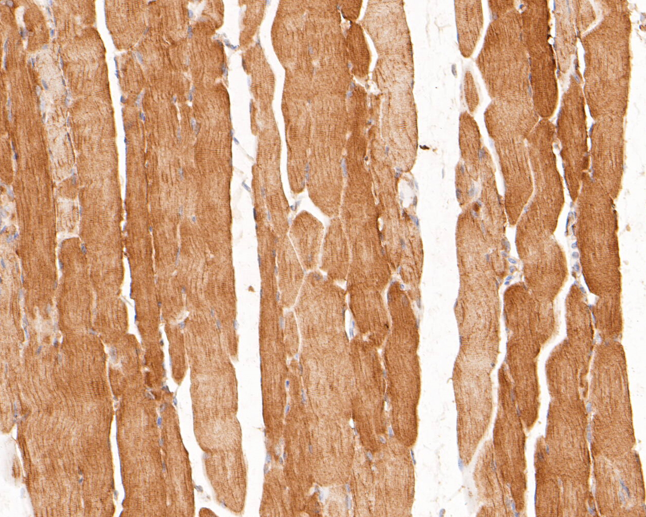 Immunohistochemical analysis of paraffin-embedded rat skeletal muscle tissue using anti-P2X6 antibody. The section was pre-treated using heat mediated antigen retrieval with Tris-EDTA buffer (pH 8.0-8.4) for 20 minutes.The tissues were blocked in 5% BSA for 30 minutes at room temperature, washed with ddH2O and PBS, and then probed with the primary antibody (ER1901-49, 1/50) for 30 minutes at room temperature. The detection was performed using an HRP conjugated compact polymer system. DAB was used as the chromogen. Tissues were counterstained with hematoxylin and mounted with DPX.