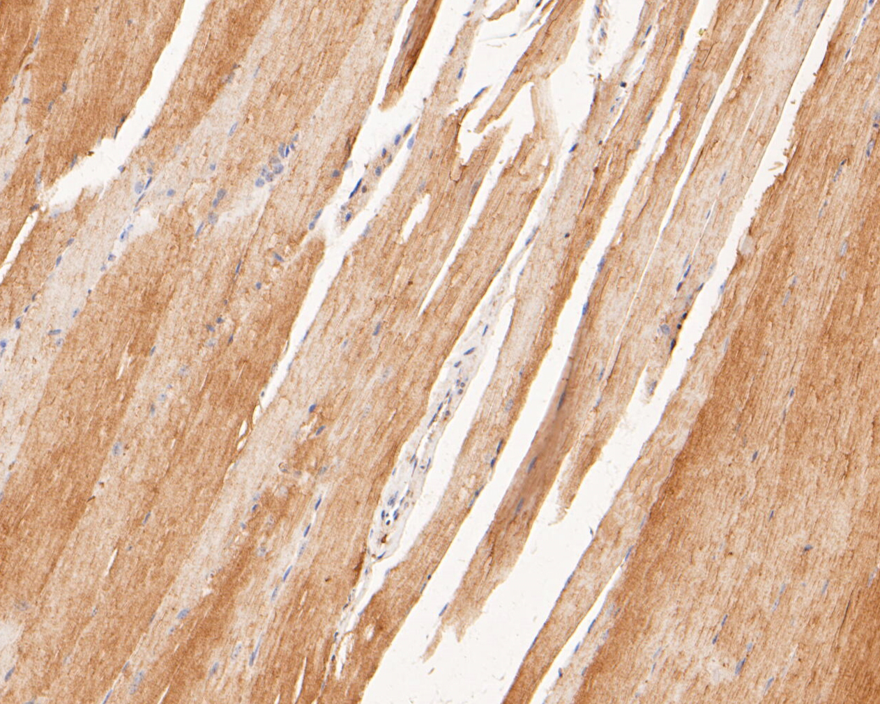 Immunohistochemical analysis of paraffin-embedded mouse skeletal muscle tissue using anti-P2X6 antibody. The section was pre-treated using heat mediated antigen retrieval with Tris-EDTA buffer (pH 8.0-8.4) for 20 minutes.The tissues were blocked in 5% BSA for 30 minutes at room temperature, washed with ddH2O and PBS, and then probed with the primary antibody (ER1901-49, 1/50) for 30 minutes at room temperature. The detection was performed using an HRP conjugated compact polymer system. DAB was used as the chromogen. Tissues were counterstained with hematoxylin and mounted with DPX.