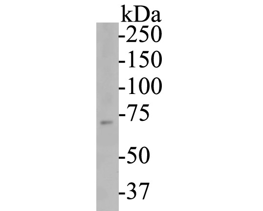 Western blot analysis of P2X7 on rat brain tissue lysates. Proteins were transferred to a PVDF membrane and blocked with 5% BSA in PBS for 1 hour at room temperature. The primary antibody (ER1901-50, 1/500) was used in 5% BSA at room temperature for 2 hours. Goat Anti-Rabbit IgG - HRP Secondary Antibody (HA1001) at 1:5,000 dilution was used for 1 hour at room temperature.