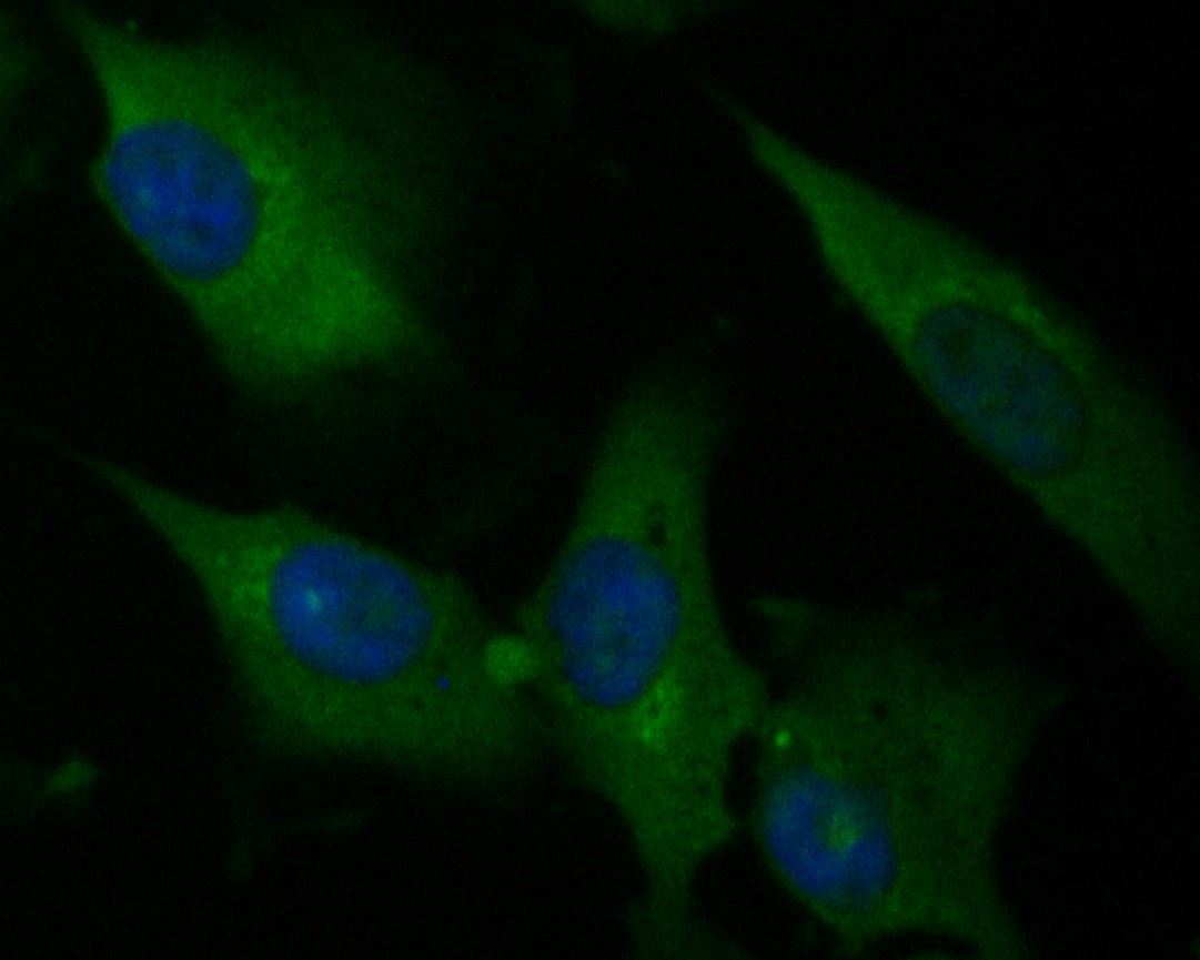 ICC staining of P2X7 in EA.hy926 cells (green). Formalin fixed cells were permeabilized with 0.1% Triton X-100 in TBS for 10 minutes at room temperature and blocked with 1% Blocker BSA for 15 minutes at room temperature. Cells were probed with the primary antibody (ER1901-50, 1/50) for 1 hour at room temperature, washed with PBS. Alexa Fluor®488 Goat anti-Rabbit IgG was used as the secondary antibody at 1/1,000 dilution. The nuclear counter stain is DAPI (blue).