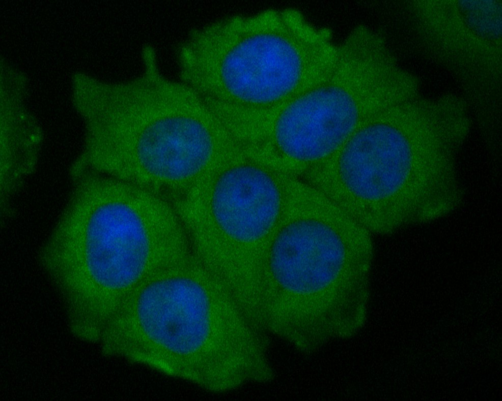 ICC staining of P2X7 in MCF-7 cells (green). Formalin fixed cells were permeabilized with 0.1% Triton X-100 in TBS for 10 minutes at room temperature and blocked with 1% Blocker BSA for 15 minutes at room temperature. Cells were probed with the primary antibody (ER1901-50, 1/50) for 1 hour at room temperature, washed with PBS. Alexa Fluor®488 Goat anti-Rabbit IgG was used as the secondary antibody at 1/1,000 dilution. The nuclear counter stain is DAPI (blue).