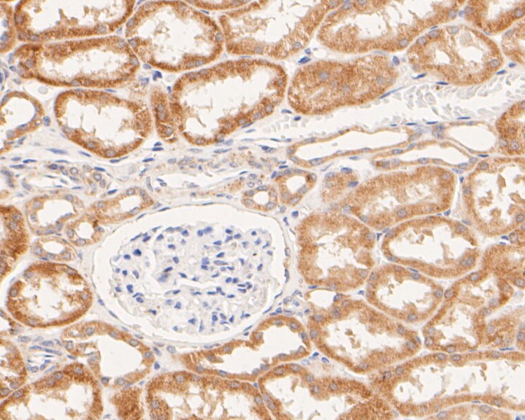 Immunohistochemical analysis of paraffin-embedded human kidney tissue using anti-P2X7 antibody. The section was pre-treated using heat mediated antigen retrieval with Tris-EDTA buffer (pH 8.0-8.4) for 20 minutes.The tissues were blocked in 5% BSA for 30 minutes at room temperature, washed with ddH2O and PBS, and then probed with the primary antibody (ER1901-50, 1/50) for 30 minutes at room temperature. The detection was performed using an HRP conjugated compact polymer system. DAB was used as the chromogen. Tissues were counterstained with hematoxylin and mounted with DPX.