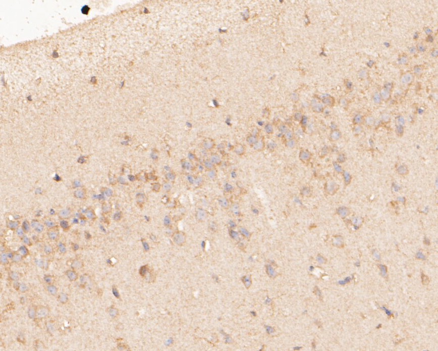Immunohistochemical analysis of paraffin-embedded mouse brain tissue using anti-P2X7 antibody. The section was pre-treated using heat mediated antigen retrieval with Tris-EDTA buffer (pH 8.0-8.4) for 20 minutes.The tissues were blocked in 5% BSA for 30 minutes at room temperature, washed with ddH2O and PBS, and then probed with the primary antibody (ER1901-50, 1/50) for 30 minutes at room temperature. The detection was performed using an HRP conjugated compact polymer system. DAB was used as the chromogen. Tissues were counterstained with hematoxylin and mounted with DPX.