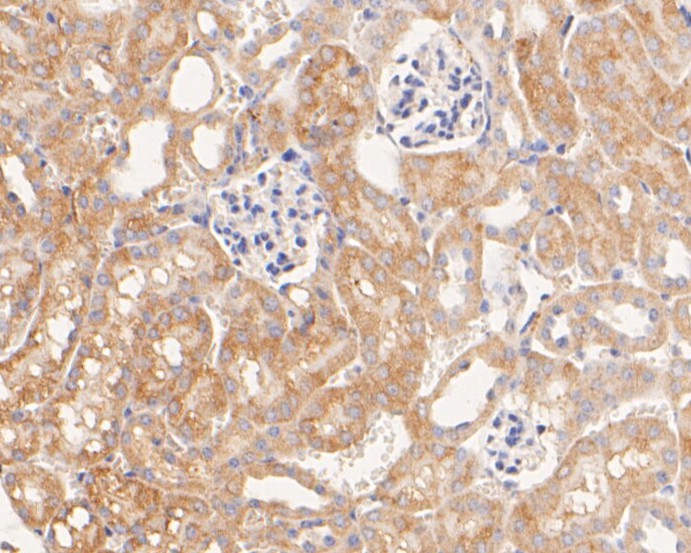 Immunohistochemical analysis of paraffin-embedded mouse kidney tissue using anti-P2X7 antibody. The section was pre-treated using heat mediated antigen retrieval with Tris-EDTA buffer (pH 8.0-8.4) for 20 minutes.The tissues were blocked in 5% BSA for 30 minutes at room temperature, washed with ddH2O and PBS, and then probed with the primary antibody (ER1901-50, 1/50) for 30 minutes at room temperature. The detection was performed using an HRP conjugated compact polymer system. DAB was used as the chromogen. Tissues were counterstained with hematoxylin and mounted with DPX.