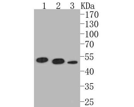 Western blot analysis of P2RX1 on different lysates. Proteins were transferred to a PVDF membrane and blocked with 5% BSA in PBS for 1 hour at room temperature. The primary antibody (ER1901-53, 1/500) was used in 5% BSA at room temperature for 2 hours. Goat Anti-Rabbit IgG - HRP Secondary Antibody (HA1001) at 1:5,000 dilution was used for 1 hour at room temperature.<br />
Positive control: <br />
Lane 1: Mouse brain tissue lysate<br />
Lane 2: Mouse cerebellum tissue lysate<br />
Lane 3: SH-SY5Y cell lysate