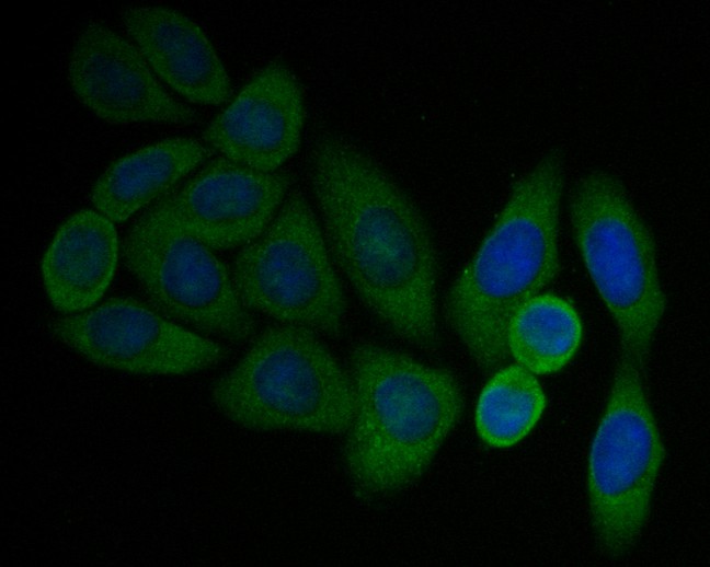 ICC staining of P2RX1 in SiHa cells (green). Formalin fixed cells were permeabilized with 0.1% Triton X-100 in TBS for 10 minutes at room temperature and blocked with 1% Blocker BSA for 15 minutes at room temperature. Cells were probed with the primary antibody (ER1901-53, 1/50) for 1 hour at room temperature, washed with PBS. Alexa Fluor®488 Goat anti-Rabbit IgG was used as the secondary antibody at 1/1,000 dilution. The nuclear counter stain is DAPI (blue).