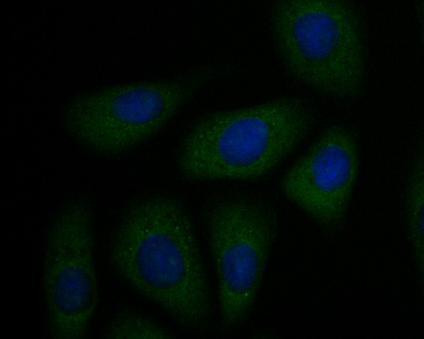 ICC staining of P2RX1 in SKOV-3 cells (green). Formalin fixed cells were permeabilized with 0.1% Triton X-100 in TBS for 10 minutes at room temperature and blocked with 1% Blocker BSA for 15 minutes at room temperature. Cells were probed with the primary antibody (ER1901-53, 1/50) for 1 hour at room temperature, washed with PBS. Alexa Fluor®488 Goat anti-Rabbit IgG was used as the secondary antibody at 1/1,000 dilution. The nuclear counter stain is DAPI (blue).