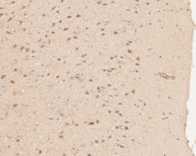 Immunohistochemical analysis of paraffin-embedded rat brain tissue using anti-P2RX1 antibody. The section was pre-treated using heat mediated antigen retrieval with Tris-EDTA buffer (pH 8.0-8.4) for 20 minutes.The tissues were blocked in 5% BSA for 30 minutes at room temperature, washed with ddH2O and PBS, and then probed with the primary antibody (ER1901-53, 1/50) for 30 minutes at room temperature. The detection was performed using an HRP conjugated compact polymer system. DAB was used as the chromogen. Tissues were counterstained with hematoxylin and mounted with DPX.