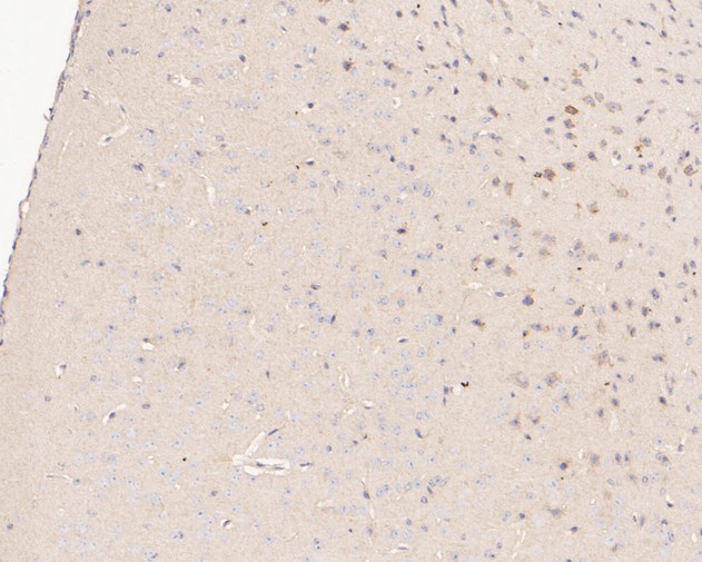 Immunohistochemical analysis of paraffin-embedded mouse brain tissue using anti-P2RX1 antibody. The section was pre-treated using heat mediated antigen retrieval with Tris-EDTA buffer (pH 8.0-8.4) for 20 minutes.The tissues were blocked in 5% BSA for 30 minutes at room temperature, washed with ddH2O and PBS, and then probed with the primary antibody (ER1901-53, 1/50) for 30 minutes at room temperature. The detection was performed using an HRP conjugated compact polymer system. DAB was used as the chromogen. Tissues were counterstained with hematoxylin and mounted with DPX.