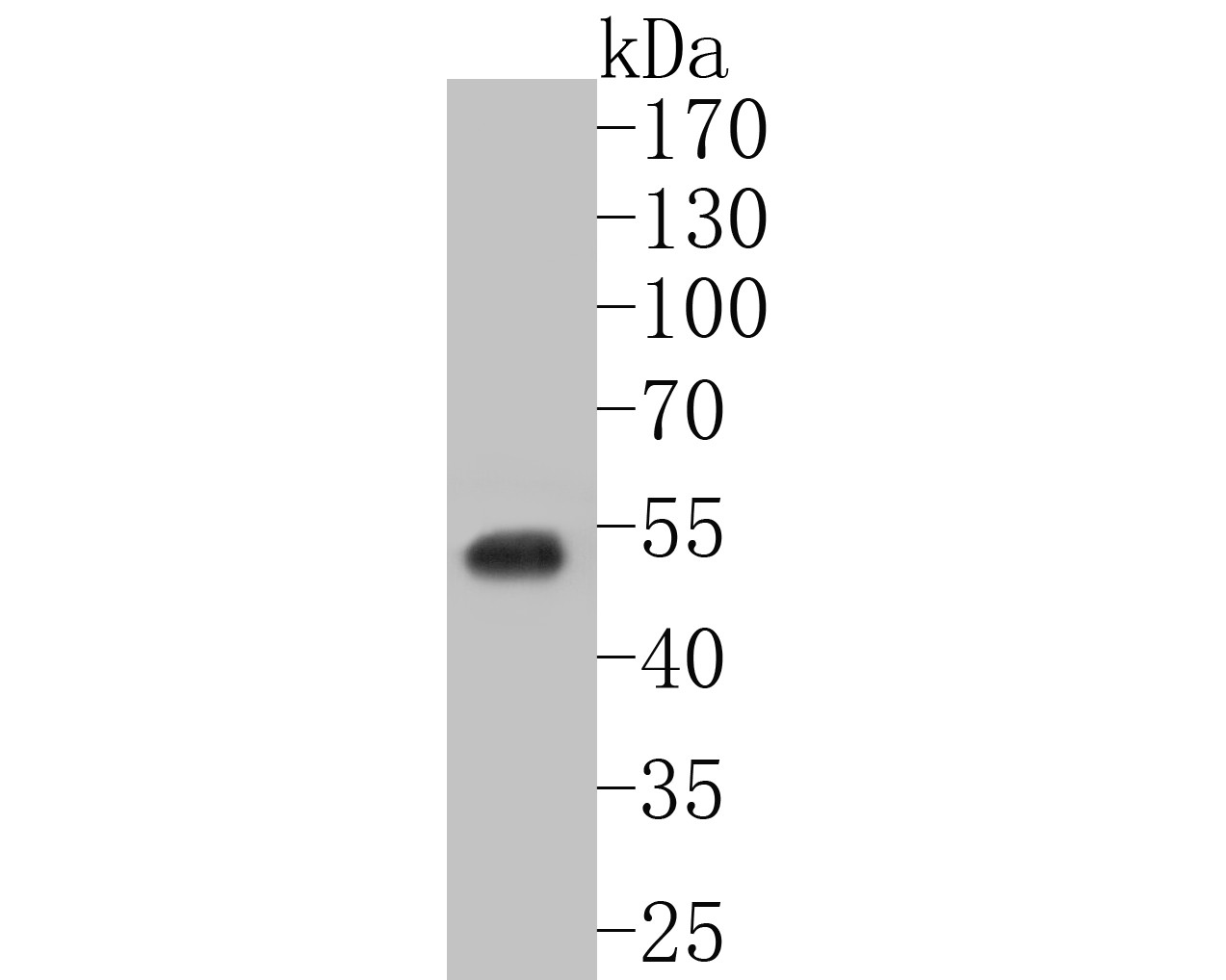 Western blot analysis of GABRD on HT-29 cell lysates. Proteins were transferred to a PVDF membrane and blocked with 5% BSA in PBS for 1 hour at room temperature. The primary antibody (ER1901-54, 1/2,000) was used in 5% BSA at room temperature for 2 hours. Goat Anti-Rabbit IgG - HRP Secondary Antibody (HA1001) at 1:5,000 dilution was used for 1 hour at room temperature.