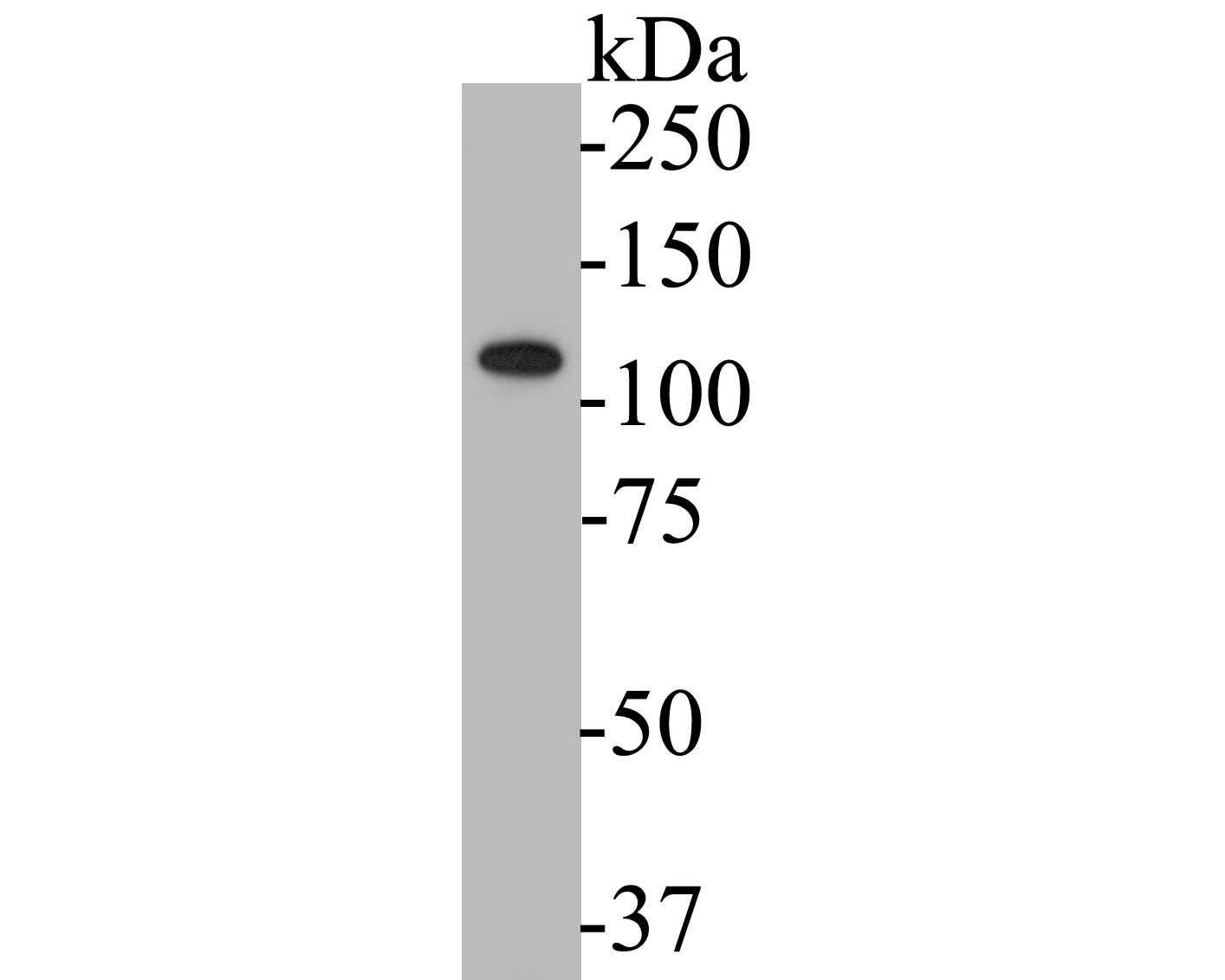 Western blot analysis of KV2.2 on SH-SY5Y cell lysates. Proteins were transferred to a PVDF membrane and blocked with 5% BSA in PBS for 1 hour at room temperature. The primary antibody (ER1901-55, 1/500) was used in 5% BSA at room temperature for 2 hours. Goat Anti-Rabbit IgG - HRP Secondary Antibody (HA1001) at 1:5,000 dilution was used for 1 hour at room temperature.