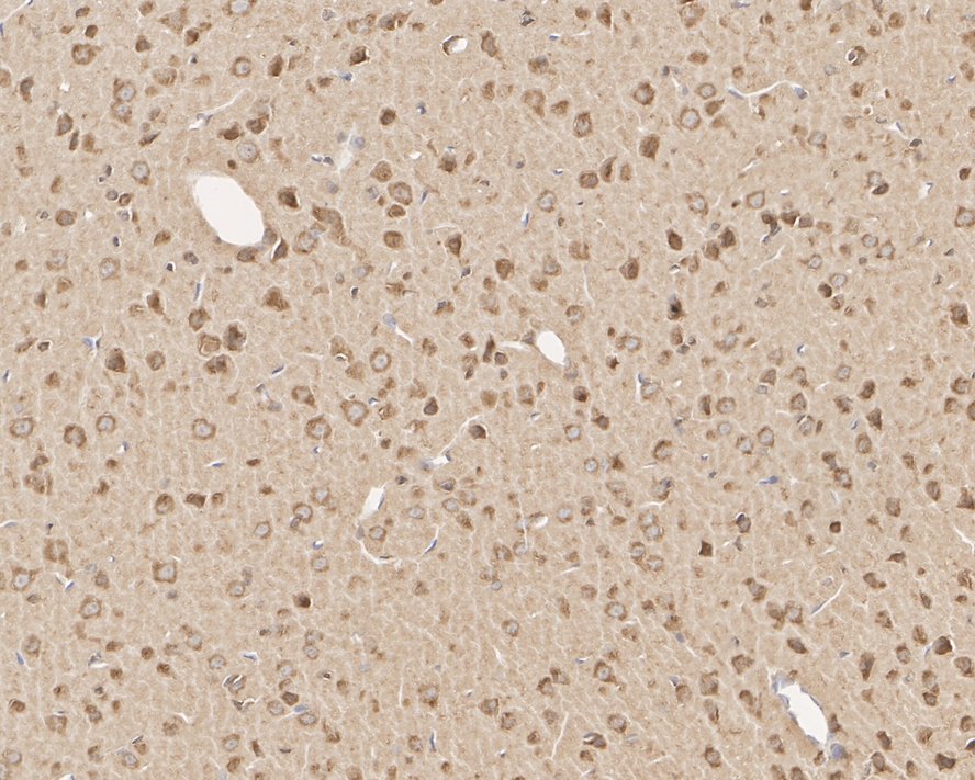 Immunohistochemical analysis of paraffin-embedded rat brain tissue using anti-KV2.2 antibody. The section was pre-treated using heat mediated antigen retrieval with Tris-EDTA buffer (pH 8.0-8.4) for 20 minutes.The tissues were blocked in 5% BSA for 30 minutes at room temperature, washed with ddH2O and PBS, and then probed with the primary antibody (ER1901-55, 1/50) for 30 minutes at room temperature. The detection was performed using an HRP conjugated compact polymer system. DAB was used as the chromogen. Tissues were counterstained with hematoxylin and mounted with DPX.