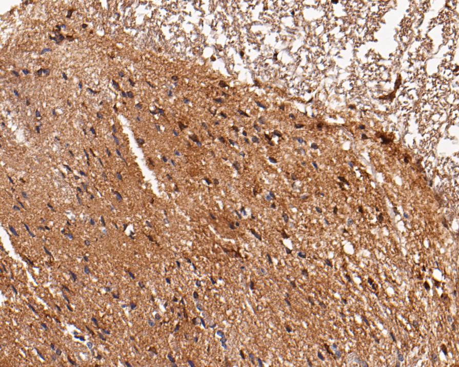 Immunohistochemical analysis of paraffin-embedded rat spinal cord tissue using anti-LGI1 antibody. The section was pre-treated using heat mediated antigen retrieval with Tris-EDTA buffer (pH 9.0) for 20 minutes.The tissues were blocked in 5% BSA for 30 minutes at room temperature, washed with ddH2O and PBS, and then probed with the primary antibody (ER1901-57, 1/50) for 30 minutes at room temperature. The detection was performed using an HRP conjugated compact polymer system. DAB was used as the chromogen. Tissues were counterstained with hematoxylin and mounted with DPX.