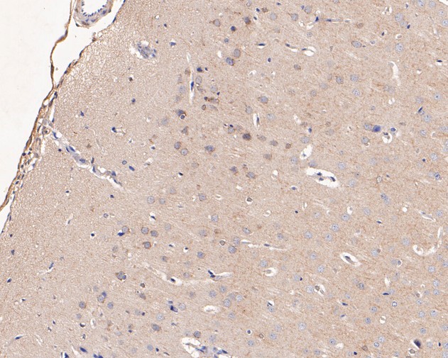 Immunohistochemical analysis of paraffin-embedded rat brain tissue using anti-LGI1 antibody. The section was pre-treated using heat mediated antigen retrieval with Tris-EDTA buffer (pH 9.0) for 20 minutes.The tissues were blocked in 5% BSA for 30 minutes at room temperature, washed with ddH2O and PBS, and then probed with the primary antibody (ER1901-57, 1/50) for 30 minutes at room temperature. The detection was performed using an HRP conjugated compact polymer system. DAB was used as the chromogen. Tissues were counterstained with hematoxylin and mounted with DPX.