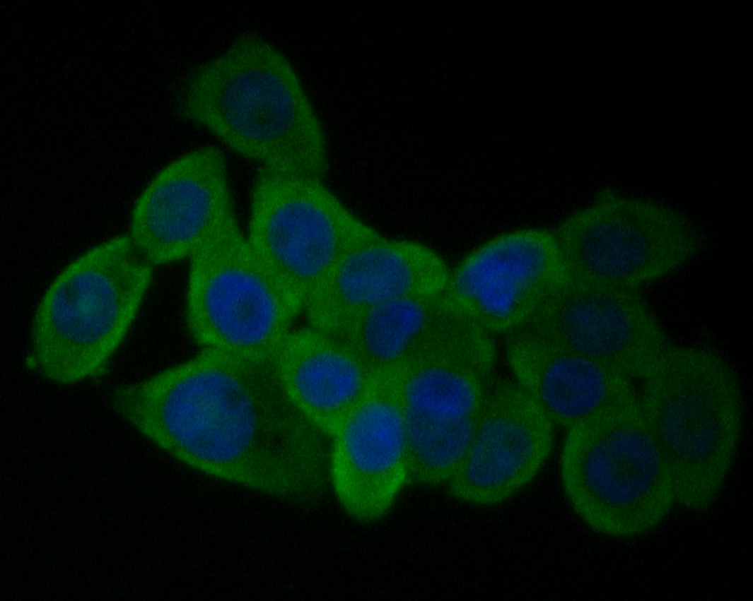 ICC staining of GABRA1 in LOVO cells (green). Formalin fixed cells were permeabilized with 0.1% Triton X-100 in TBS for 10 minutes at room temperature and blocked with 1% Blocker BSA for 15 minutes at room temperature. Cells were probed with the primary antibody (ER1901-58, 1/50) for 1 hour at room temperature, washed with PBS. Alexa Fluor®488 Goat anti-Rabbit IgG was used as the secondary antibody at 1/1,000 dilution. The nuclear counter stain is DAPI (blue).