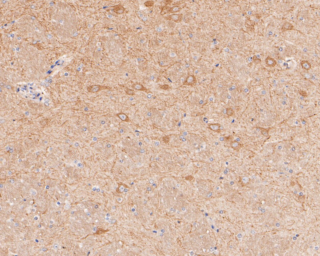 Immunohistochemical analysis of paraffin-embedded rat brain tissue using anti-GABRA1 antibody. The section was pre-treated using heat mediated antigen retrieval with Tris-EDTA buffer (pH 8.0-8.4) for 20 minutes.The tissues were blocked in 5% BSA for 30 minutes at room temperature, washed with ddH2O and PBS, and then probed with the primary antibody (ER1901-58, 1/50) for 30 minutes at room temperature. The detection was performed using an HRP conjugated compact polymer system. DAB was used as the chromogen. Tissues were counterstained with hematoxylin and mounted with DPX.