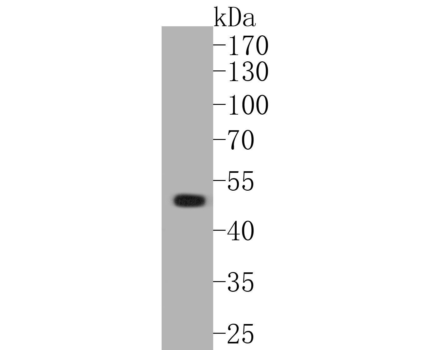 Western blot analysis of GABRA1 on rat cerebellum tissue lysates. Proteins were transferred to a PVDF membrane and blocked with 5% BSA in PBS for 1 hour at room temperature. The primary antibody (ER1901-59, 1/1000) was used in 5% BSA at room temperature for 2 hours. Goat Anti-Rabbit IgG - HRP Secondary Antibody (HA1001) at 1:5,000 dilution was used for 1 hour at room temperature.