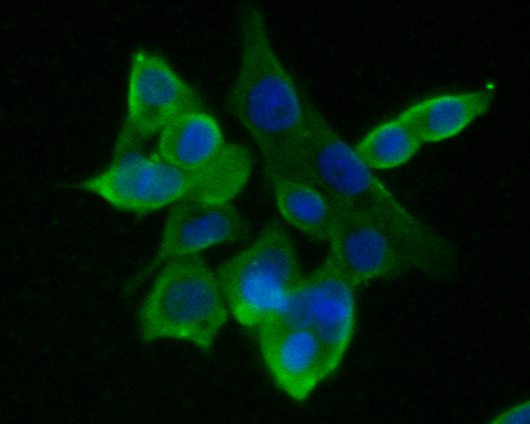 ICC staining of GABRA1 in LOVO cells (green). Formalin fixed cells were permeabilized with 0.1% Triton X-100 in TBS for 10 minutes at room temperature and blocked with 1% Blocker BSA for 15 minutes at room temperature. Cells were probed with the primary antibody (ER1901-59, 1/50) for 1 hour at room temperature, washed with PBS. Alexa Fluor®488 Goat anti-Rabbit IgG was used as the secondary antibody at 1/1,000 dilution. The nuclear counter stain is DAPI (blue).