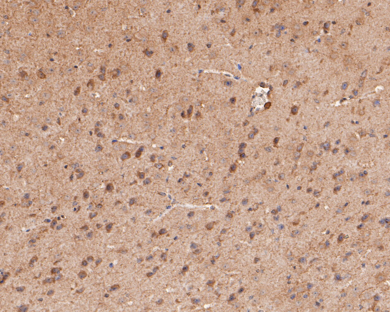 Immunohistochemical analysis of paraffin-embedded mouse brain tissue using anti-GABRA4 antibody. The section was pre-treated using heat mediated antigen retrieval with Tris-EDTA buffer (pH 8.0-8.4) for 20 minutes.The tissues were blocked in 5% BSA for 30 minutes at room temperature, washed with ddH2O and PBS, and then probed with the primary antibody (ER1901-60, 1/50) for 30 minutes at room temperature. The detection was performed using an HRP conjugated compact polymer system. DAB was used as the chromogen. Tissues were counterstained with hematoxylin and mounted with DPX.