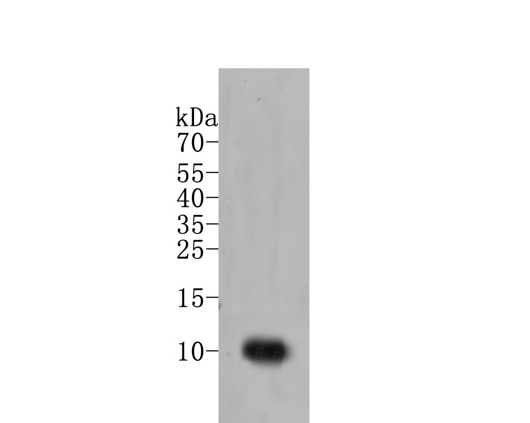 Western blot analysis of IL8 on human kidney tissue lysate. Proteins were transferred to a PVDF membrane and blocked with 5% BSA in PBS for 1 hour at room temperature. The primary antibody (ER1901-61, 1/200) was used in 5% BSA at room temperature for 2 hours. Goat Anti-Rabbit IgG - HRP Secondary Antibody (HA1001) at 1:5,000 dilution was used for 1 hour at room temperature.