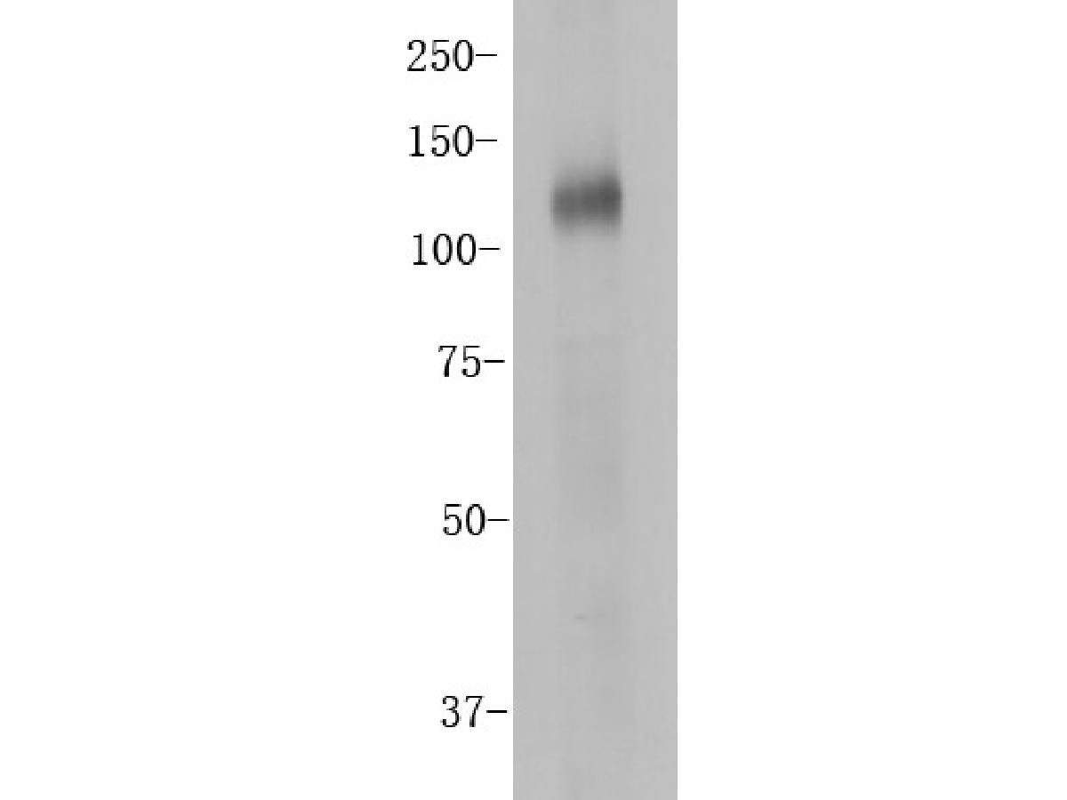 Western blot analysis of CD133 on HT-29 cell lysates. Proteins were transferred to a PVDF membrane and blocked with 5% BSA in PBS for 1 hour at room temperature. The primary antibody (ER1901-63, 1/500) was used in 5% BSA at room temperature for 2 hours. Goat Anti-Rabbit IgG - HRP Secondary Antibody (HA1001) at 1:5,000 dilution was used for 1 hour at room temperature.