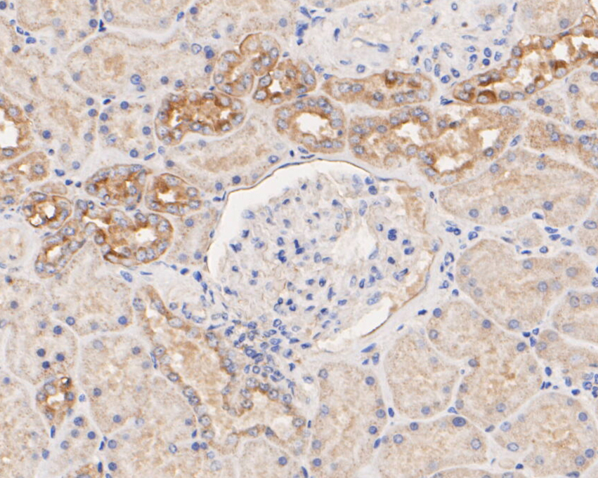 Immunohistochemical analysis of paraffin-embedded human kidney tissue using anti-CD133 antibody. The section was pre-treated using heat mediated antigen retrieval with Tris-EDTA buffer (pH 8.0-8.4) for 20 minutes.The tissues were blocked in 5% BSA for 30 minutes at room temperature, washed with ddH2O and PBS, and then probed with the primary antibody (ER1901-63, 1/100) for 30 minutes at room temperature. The detection was performed using an HRP conjugated compact polymer system. DAB was used as the chromogen. Tissues were counterstained with hematoxylin and mounted with DPX.