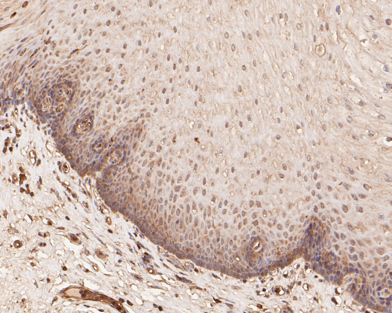Immunohistochemical analysis of paraffin-embedded human esophagus tissue using anti-ZHX2 antibody. The section was pre-treated using heat mediated antigen retrieval with sodium citrate buffer (pH 6.0) for 20 minutes. The tissues were blocked in 5% BSA for 30 minutes at room temperature, washed with ddH2O and PBS, and then probed with the primary antibody (ER1901-64, 1/50)  for 30 minutes at room temperature. The detection was performed using an HRP conjugated compact polymer system. DAB was used as the chromogen. Tissues were counterstained with hematoxylin and mounted with DPX.