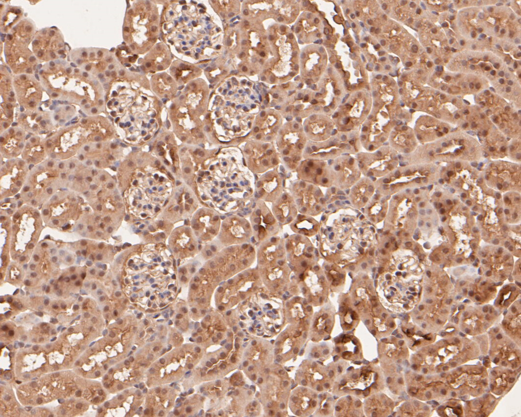 Immunohistochemical analysis of paraffin-embedded mouse kidney tissue using anti-ZHX2 antibody. The section was pre-treated using heat mediated antigen retrieval with sodium citrate buffer (pH 6.0) for 20 minutes. The tissues were blocked in 5% BSA for 30 minutes at room temperature, washed with ddH2O and PBS, and then probed with the primary antibody (ER1901-64, 1/50)  for 30 minutes at room temperature. The detection was performed using an HRP conjugated compact polymer system. DAB was used as the chromogen. Tissues were counterstained with hematoxylin and mounted with DPX.