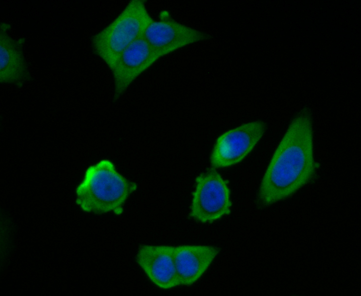 ICC staining of GAPDH in MCF-7 cells (green). Formalin fixed cells were permeabilized with 0.1% Triton X-100 in TBS for 10 minutes at room temperature and blocked with 1% Blocker BSA for 15 minutes at room temperature. Cells were probed with the antibody (ER1901-65) at a dilution of 1:100 for 1 hour at room temperature, washed with PBS. Alexa Fluor®488 Goat anti-Rabbit IgG was used as the secondary antibody at 1/100 dilution. The nuclear counter stain is DAPI (blue).