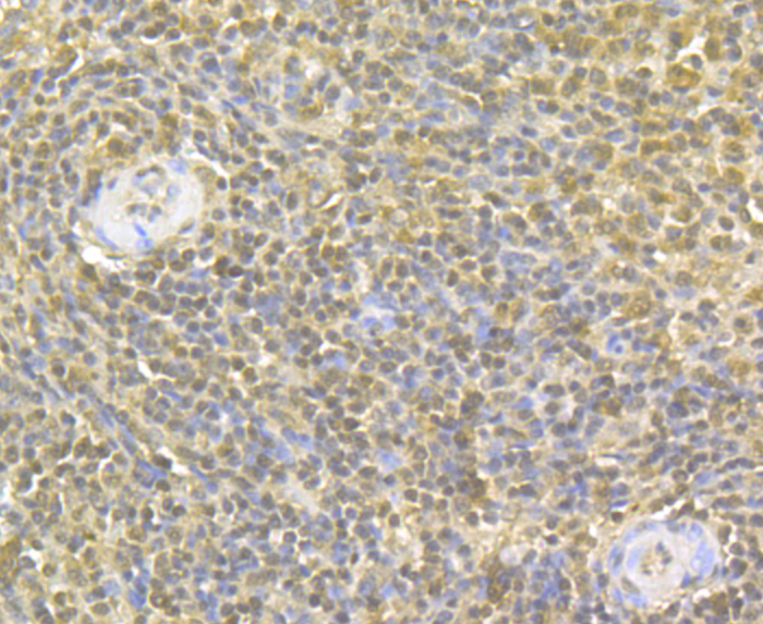 Immunohistochemical analysis of paraffin-embedded human spleen tissue using anti-GAPDH antibody. The section was pre-treated using heat mediated antigen retrieval with sodium citrate buffer (pH 6.0) for 20 minutes. The tissues were blocked in 5% BSA for 30 minutes at room temperature, washed with ddH2O and PBS, and then probed with the antibody (ER1901-65) at 1/50 dilution, for 30 minutes at room temperature and detected using an HRP conjugated compact polymer system. DAB was used as the chromogen. Counter stained with hematoxylin and mounted with DPX.