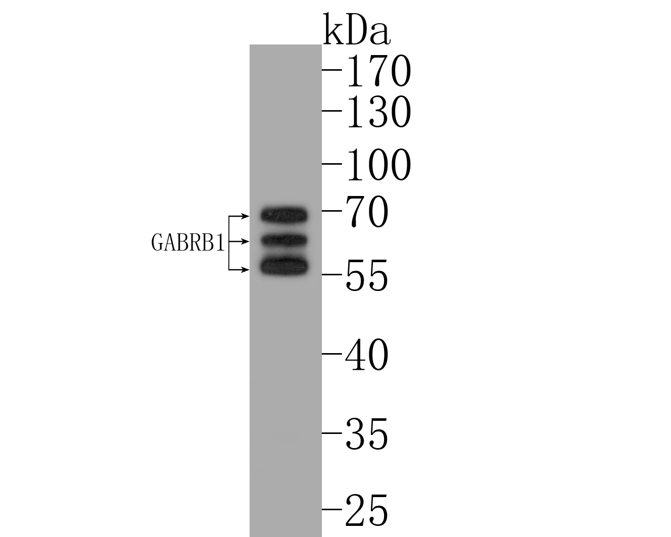 Western blot analysis of GABRB1 on rat brain tissue lysates. Proteins were transferred to a PVDF membrane and blocked with 5% BSA in PBS for 1 hour at room temperature. The primary antibody (ER1901-66, 1/500) was used in 5% BSA at room temperature for 2 hours. Goat Anti-Rabbit IgG - HRP Secondary Antibody (HA1001) at 1:5,000 dilution was used for 1 hour at room temperature.