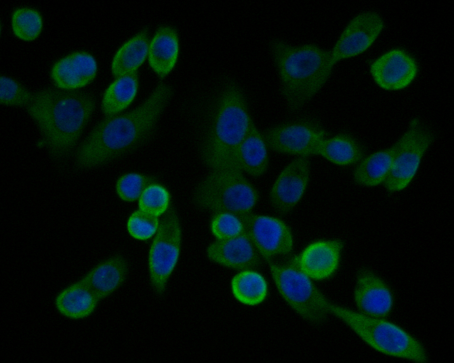 ICC staining of GABRB1 in LOVO cells (green). Formalin fixed cells were permeabilized with 0.1% Triton X-100 in TBS for 10 minutes at room temperature and blocked with 1% Blocker BSA for 15 minutes at room temperature. Cells were probed with the primary antibody (ER1901-66, 1/100) for 1 hour at room temperature, washed with PBS. Alexa Fluor®488 Goat anti-Rabbit IgG was used as the secondary antibody at 1/1,000 dilution. The nuclear counter stain is DAPI (blue).